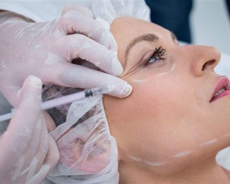 ممنوعیت سیگار پس از تزریق ژل