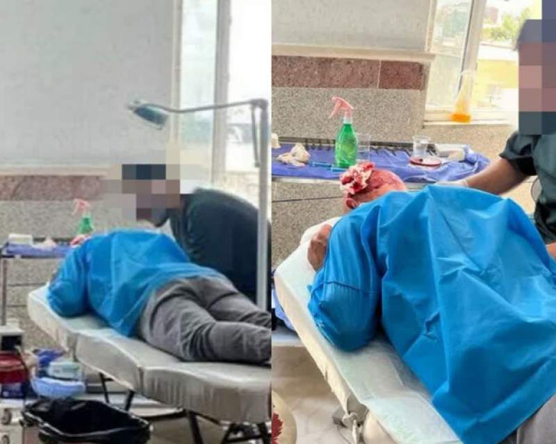 پلمب یک واحد غیرمجاز کاشت مو در پارس آباد