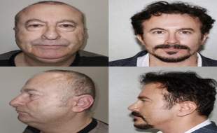 انتشار تصاویر عجیب قبل و بعد از جراحی پلاستیک توسط کلینیکی در ترکیه