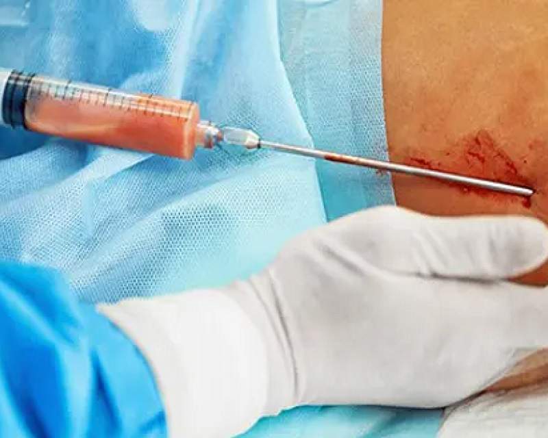 پزشک قلابی سیار در حین انجام عمل زیبایی در منزل دستگیر شد پزشک قلابی سیار در حین انجام عمل زیبایی در منزل دستگیر شد