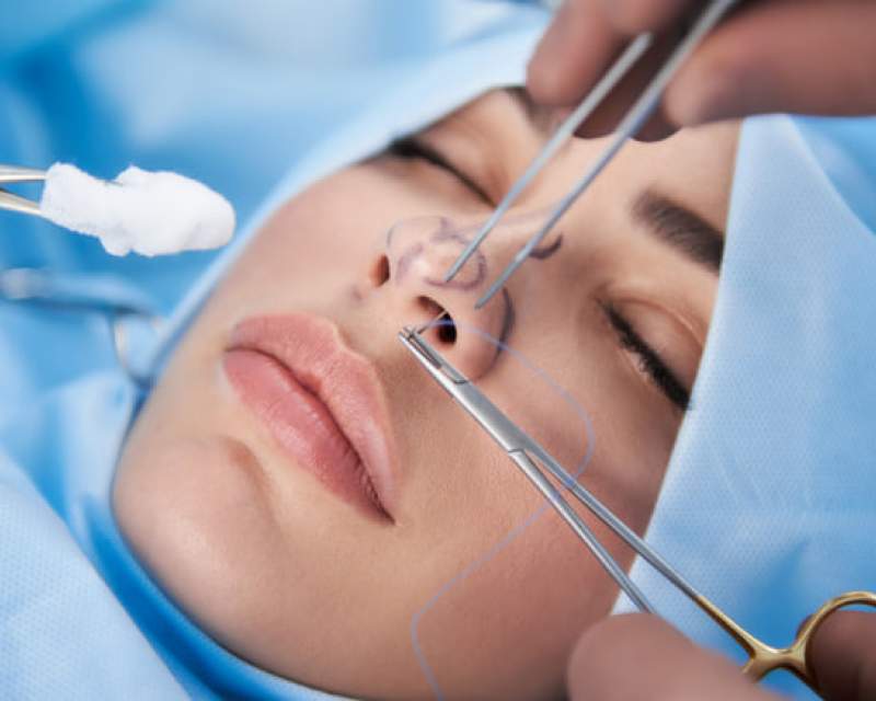 جزئیات جراحی بینی مرگبار در کلینیک زیبایی