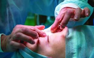 جراحی بینی بدون بیهوشی توسط دستیار دیپلمه پزشک مدعی!