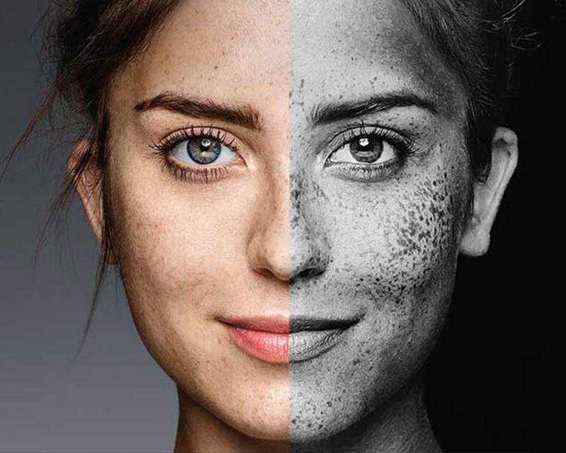 پوست در خط مقدّم آلودگی هوا پوست در خط مقدّم آلودگی هوا