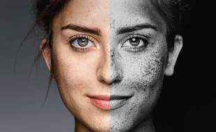 پوست در خط مقدّم آلودگی هوا