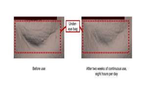 کاهش میزان پُف زیر چشم طی دو هفته با فناوری پوست دوم شیسیدو