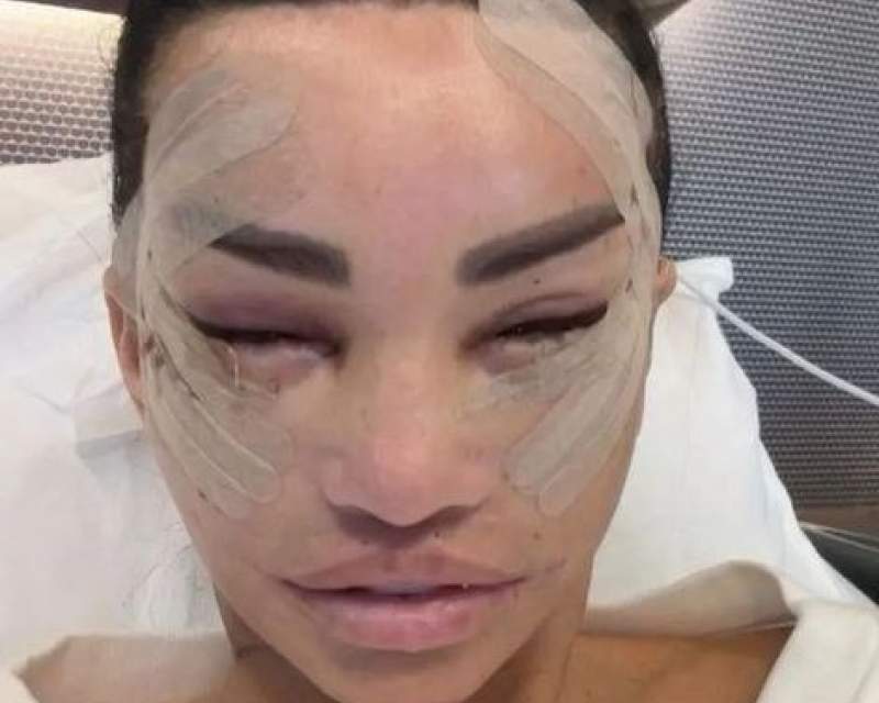 ۱۰ کشور برتر جهان از نظر تعداد اعمال زیبایی در ۲۰۲۴